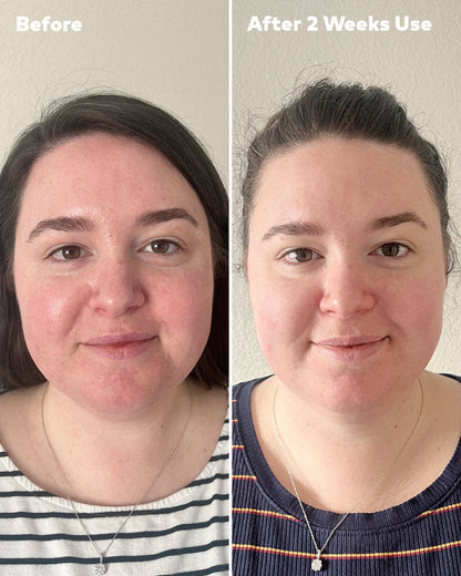 Silver Infused Mini PRO MakeUp Eraser | Acne Prone Skin: Mini PRO